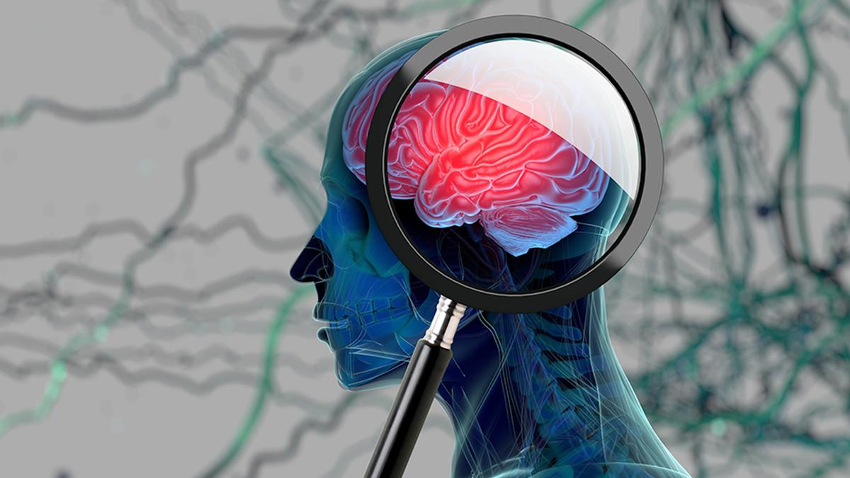 Alzheimer's is not 'just old age': early diagnosis is crucial for treatment and management